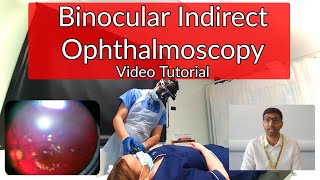 Binocular Indirect Ophthalmoscopy Tutorial [upl. by Gotthelf]