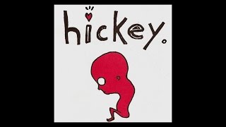 HICKEY  Hickey FULL ALBUM [upl. by Ahsaercal133]