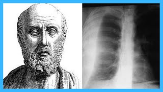 Top 12 Contributions of Hippocrates [upl. by Eyahs900]