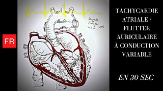 Arythmies Animation cardiaque et ECG  Flutter Auriculaire à Conduction Variable Shorts [upl. by Ahsoyem]