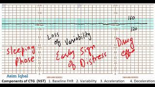 CTG Loss of Variability [upl. by Azriel955]