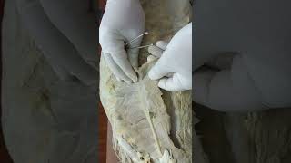 Muscles of the thoracic wall دكتور رمضان ساري [upl. by Nnairb]