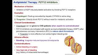 Treatment of Ischemic Heart Disease 2 Preventing Disease Progression [upl. by Aerdma]