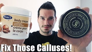 How to Treat Calluses from Weight Lifting amp Working Out [upl. by Roz715]