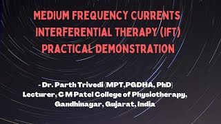 Medium Frequency Current  Interferential Therapy IFT Practical Demonstration [upl. by Ev]