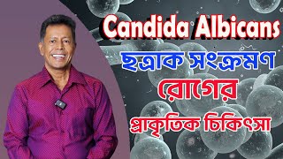 Candida Albicans  ছত্রাক সংক্রমণ রোগের প্রাকৃতিক চিকিৎসা [upl. by Queri]