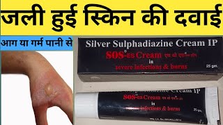 Sos cream review in Hindi  Sos cream for burn  Sos cream kis kaam aati hai [upl. by Decima365]