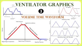 Ventilator waveforms Volume time scaler made easy [upl. by Eda703]