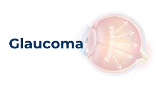 Pharmacology of Glaucoma [upl. by Nadeau]