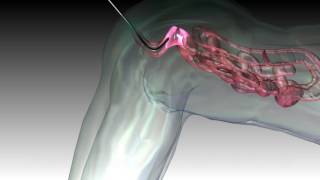 colonoscopy colon colonoscope endoscope 3d medical animation company studio 3d visualization healthc [upl. by Enirehtac]