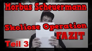 Skoliose Morbus Scheuermann Operation FAZIT DrissTalk63 [upl. by Nial]