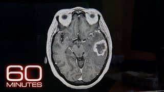 Frontotemporal Dementia  60 Minutes Archive [upl. by Suryt]