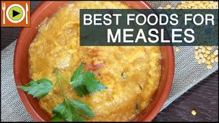 Best Foods to Cure Measles  Healthy Recipes [upl. by Nitneuq]