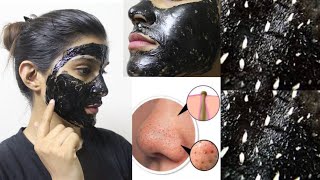 CHARCOAL Peel Off Mask Does It Work हिंदी ReviewSuper Style Tips [upl. by Albric]