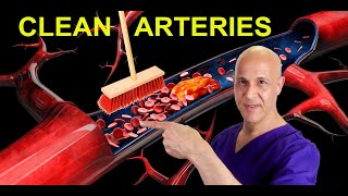 The Best Foods to Clean Arteries amp Reverse Plaque Prevent Heart Attack amp Stroke Dr Mandell [upl. by Nave]