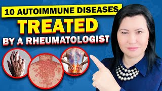 Top 10 Autoimmune Diseases A Rheumatologist Diagnose and Treat [upl. by Sakram88]