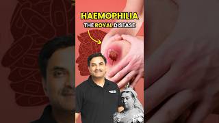 Haemophilia  Dangerous Disease 😨 biology neet shorts [upl. by Nitnelav]