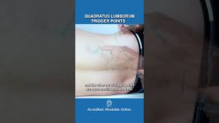 Are Quadratus Lumborum Trigger Points Causing Your Back Pain [upl. by Schwerin958]