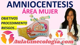 AMNIOCENTESIS y BIOPSIA DE VELLOSIDADES CORIALES CUÁNDO SE HACEN CÓMO ES LA PRUEBA RESULTADOS [upl. by Noemys]