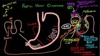 Peptic Ulcer Disease Pathophysiology [upl. by Castor856]