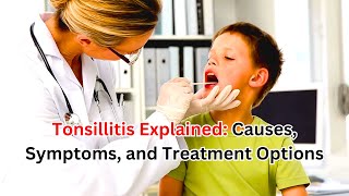 Tonsillitis Explained Causes Symptoms and Treatment Options  SF Health Tips [upl. by Felt]