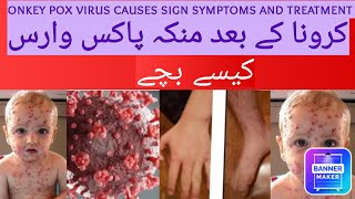 monkey pox virus health medicalinformation monkey pox virus [upl. by Ateval]