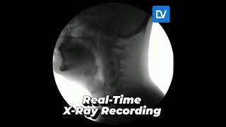 RealTime Xray – See How It WorksXrayTechnologies NDT Radiography xray xraytechnologist [upl. by Danforth359]