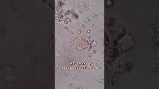 entamoeba histolytica pseudopodia locomotion through pseudopodia [upl. by Anayad]