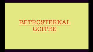 RETROSTERNAL GOITRE [upl. by Atiuqrehs221]