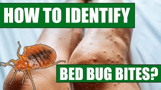 Bed bug bites vs Flea bites picturesImages [upl. by Ariday657]