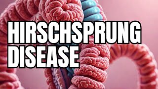 Understanding Hirschsprung Disease Key Facts 2024 [upl. by Ahso180]