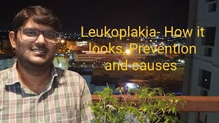 LeukoplakiaHow it looks Prevention and causes [upl. by Nallad]