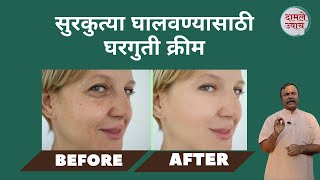 सुरकुत्या घालवण्यासाठी घरगुती क्रीम।How To Get Rid Of Face Wrinkles  Wrinkles Removal  Surkutya [upl. by Tammara217]