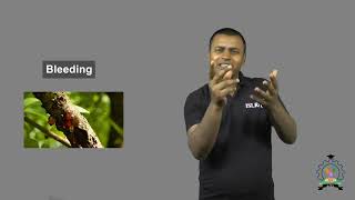 Learn Indian Sign Language Bleeding Explained [upl. by Keating]