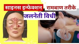 साइनस इन्फेक्शन का घरेलू समाधान  sinus problem solution hindi  sinus infection  sinusitis [upl. by Arlo]