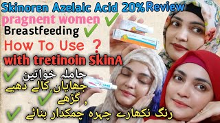 Skinoren Cream20Azelaic Acid Review How To Use Azelaic Acid With TretinoinSkinA Cream Retinoid [upl. by Elissa]