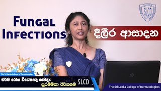 Fungal Infections දිලීර ආසාදන  Dr Surammika Eriyagama Consultant Dermatologist skincare [upl. by Eicnahc346]