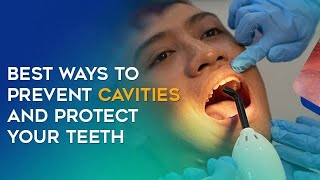 quotYour Teeth’s Worst Enemy How to Beat Cavities for Goodquot dentist caries teeth [upl. by Adabel]