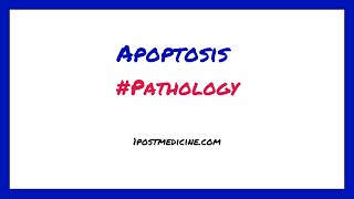 Apoptosis  Pathology [upl. by Carilyn89]