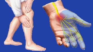 Paresthesia Causes And Symptoms [upl. by Meridel]