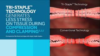 The Impact of TriStapleᵀᴹ Technology on Tissue [upl. by Llemert]