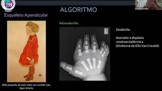 Evaluación Radiológica de las displasias esqueleticas en Pediatría [upl. by Clute]