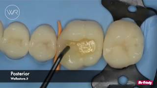 2  How to use the 3ssential kit by WeRestore for an Additive procedure [upl. by Kawasaki499]