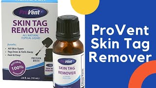 ProVent Skin Tag Remover [upl. by Carolyne]