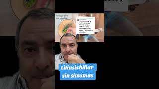 Litiasis biliar sin síntomas [upl. by Tressa983]