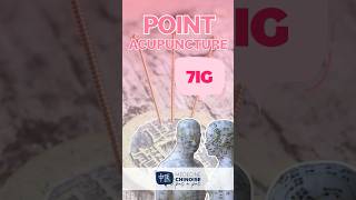 POINT D’ACUPUNCTURE  7IG  Zhi Zheng acupuncture acupuncturepoints medecinechinoise [upl. by Gnut]