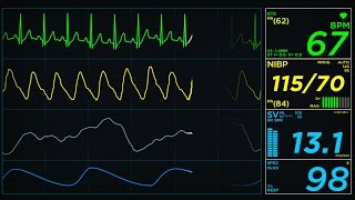 EKG Display Monitor [upl. by Donetta]