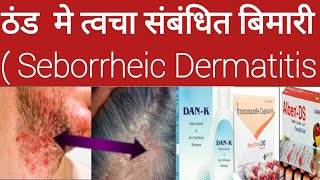 seborrheicdermatitis ठंड मे त्वचा संबंधित बिमारी । Seborrheic Dermatitis ।Abhia2zmedical [upl. by Enialem]