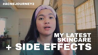 FIRST WEEK WITH ISOTRETINOIN ACNE JOURNEY 2 [upl. by Eemaj463]