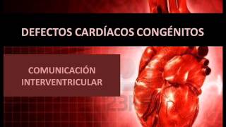 Defectos cardíacos congénitos  Comunicación interventricular [upl. by Naivatco808]